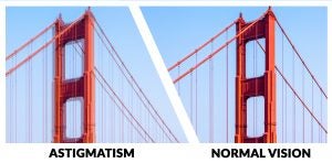 An Infographic Image of Astigmatism Vision v/s Normal Vision in Derry & Nearby Areas.