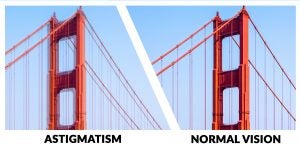 Astigmatism Vision v/s Normal Vision