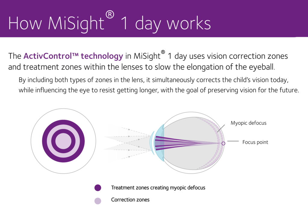 Soft Contact Lenses In Southern NH