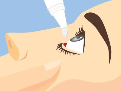 A person dropping eye drop solution in the eye
