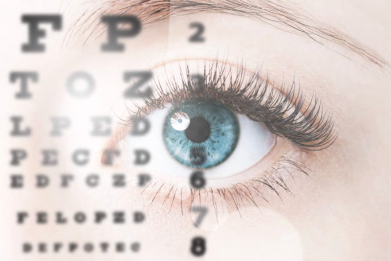 Lasik Surgery