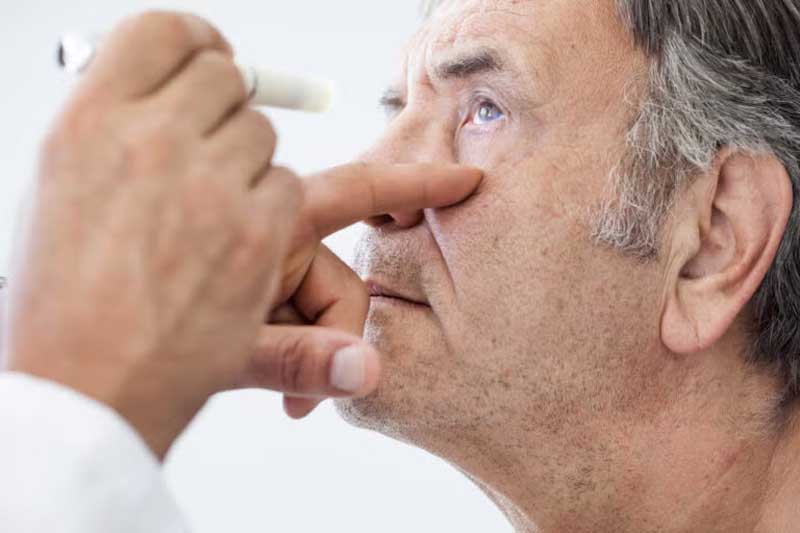 doctor checking eye