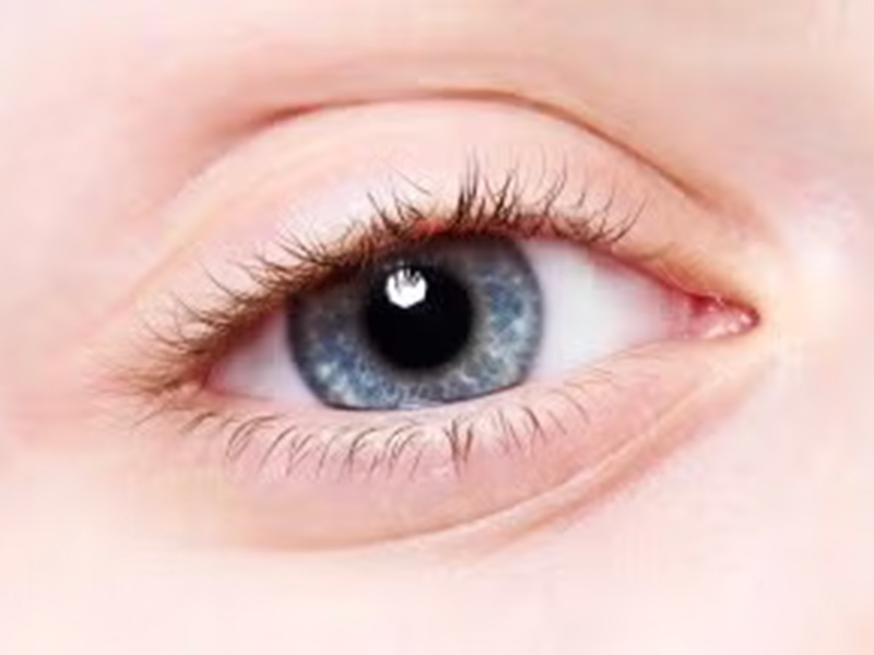 lasik eye surgery in manchester