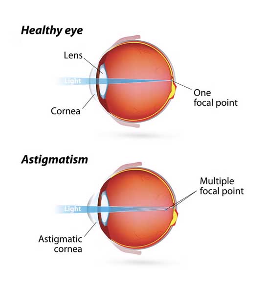 healthy eye