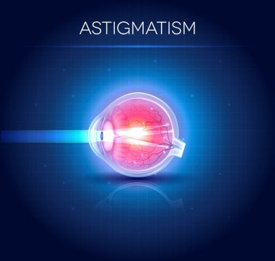 Astigmatism