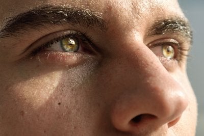 Intense Pulsed Light Treatment in Derry & Surrounding Areas